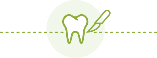 dental surgery illustration