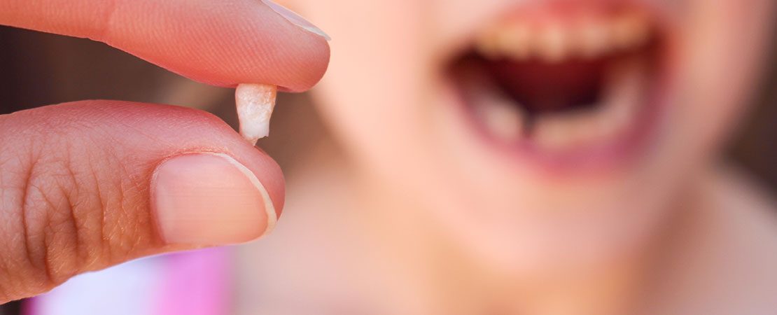 Your Child’s First Loose Tooth
