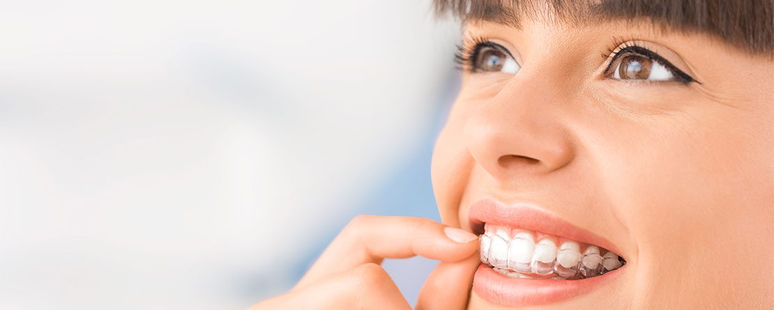 Invisalign Edinburg, IL